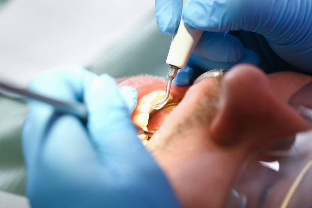 Best Emergency Root Canal Therapy in Sabetha, KS