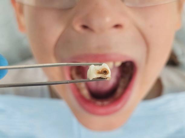 Best Emergency Dental Care for Sports Injuries in Sabetha, KS