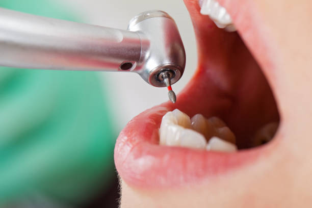 Best Emergency Cosmetic Dentistry (e.g., broken veneers) in Sabetha, KS